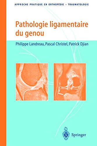 Pathologie ligamentaire du genou