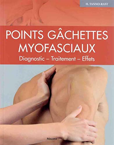 Points gâchettes myofasciaux : diagnostic, traitement, effets