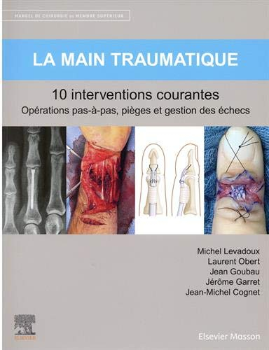 Manuel de chirurgie du membre supérieur. Vol. 2. La main traumatique : 10 interventions courantes : 