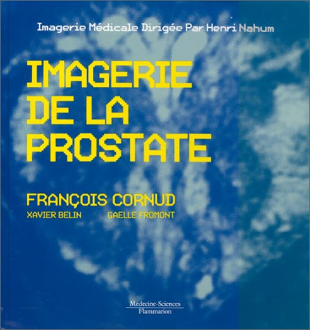 L'Imagerie de la prostate